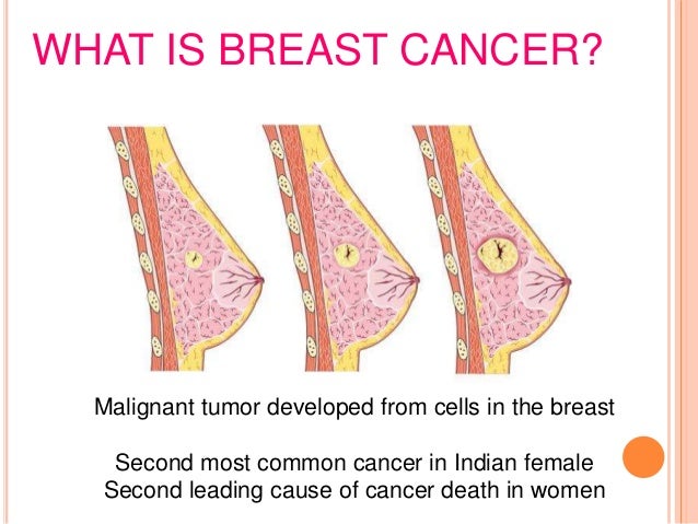 how breasts develop How breasts develop